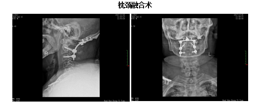 微信截图_20191017171731.png