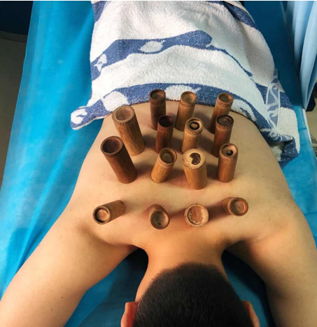 市中医医院|体验特色疗法,感受中医药魅力